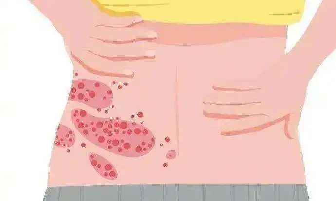 这个病终于有疫苗了,开打