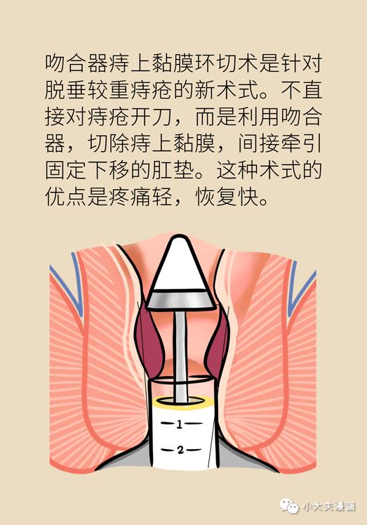 局部出血怎么治,局部出血怎么处理