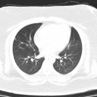 新冠病毒中医方案,新冠少阳辨证