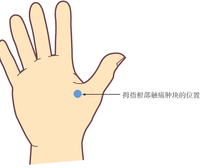 肩部运动损伤的检查4个方法,肩部各种损伤