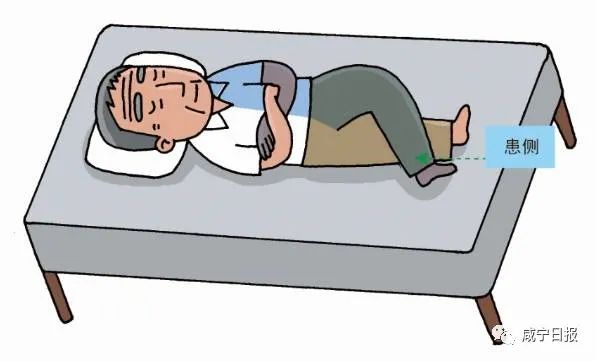 中风信号莫忽视,中风病人要特别注意保暖吗