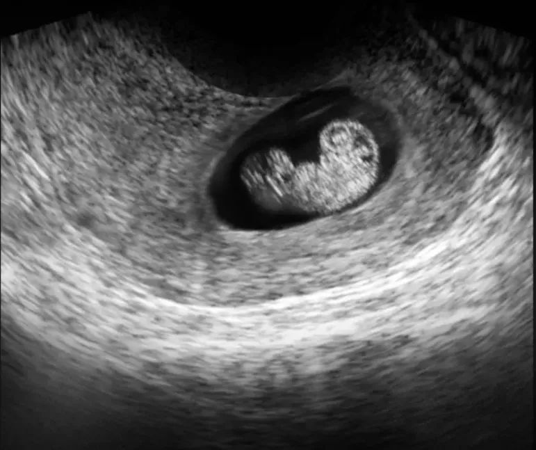 健康一点通怎么查看体检报告,健康孕检单视频