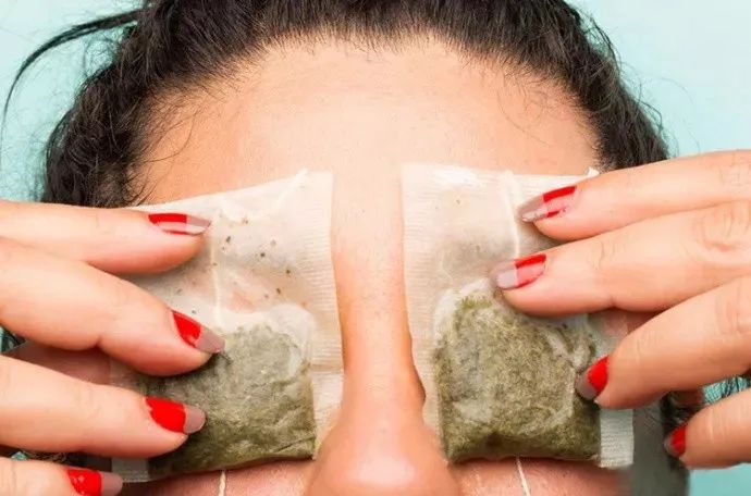 严重黑眼圈是身体发出的信号吗,黑眼圈不可怕