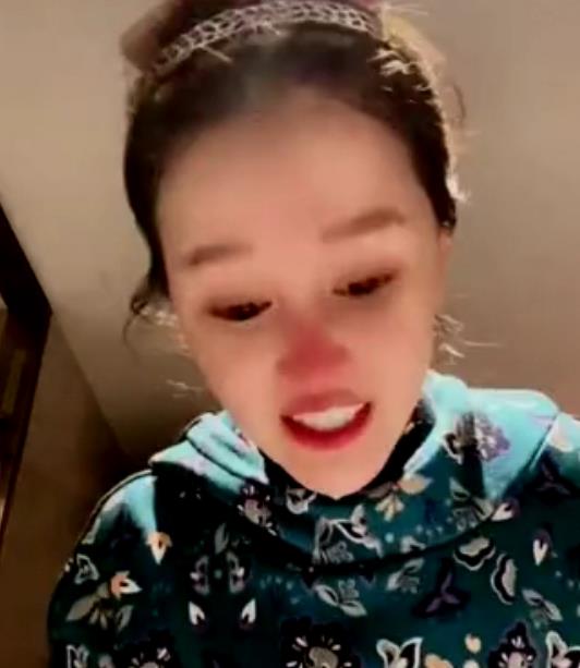 赵本山女儿承认整容了吗,赵本山女儿整容被质疑