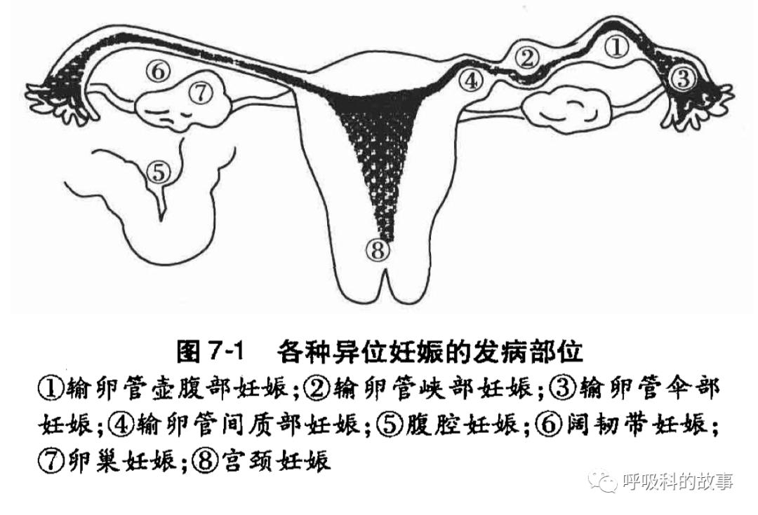 不一样的“月经”，不一样的PBL课