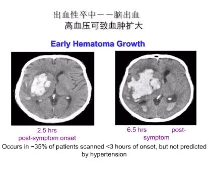 脑出血康复后怎么控制血压,脑出血保守治疗后七天血压升高