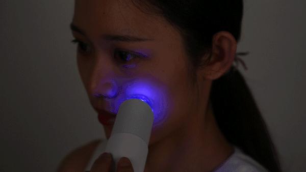 痘痘挤出的白米粒是什么,痘痘挤出来的白色乳浆是什么