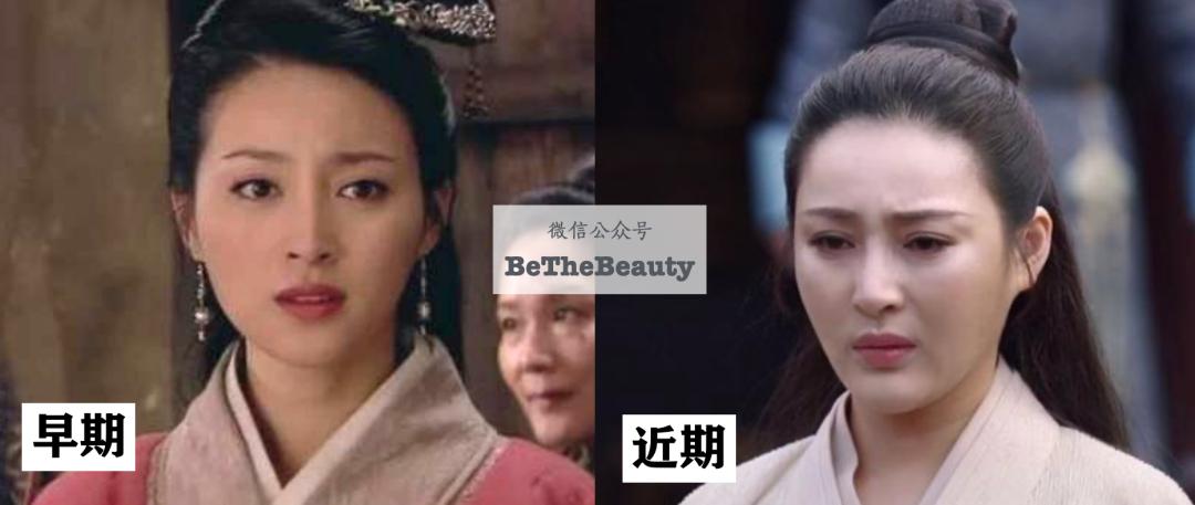 为什么网红脸显得好看,网红脸与高级脸是否有相同之处