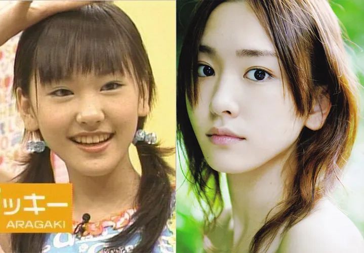 眼综合包含在眼综合吗,眼综合每个人都适合吗