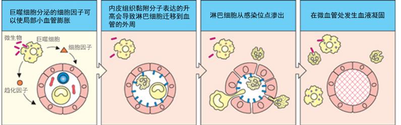 炎症的自述：发生、机理和结局