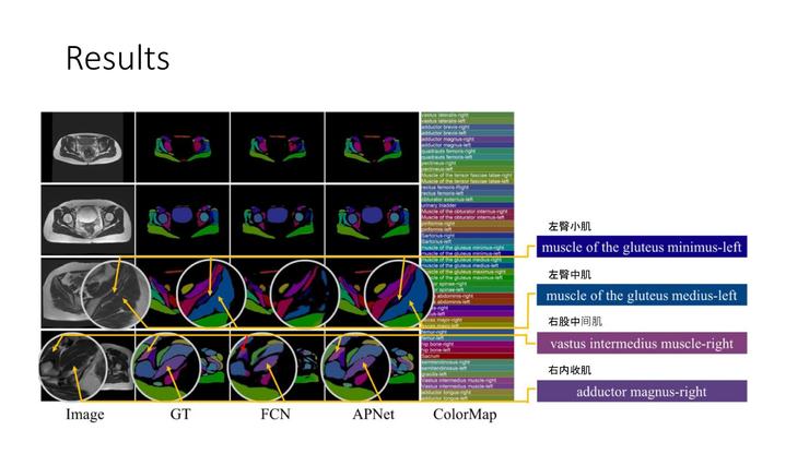 陆菁菁北京协和医院,陆菁菁和睦家
