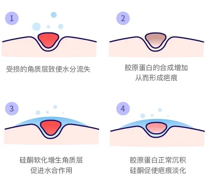 淡化疤痕原来淡疤可以这样做,每天用它擦一擦轻轻松松去除疤痕