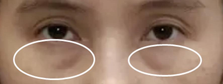 欧阳娜娜关晓彤眼霜,欧阳娜娜眼霜去黑眼圈