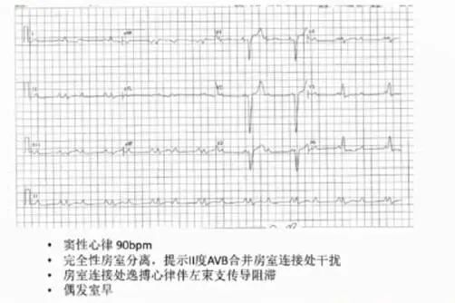 病例学习分享,病例分享第四期