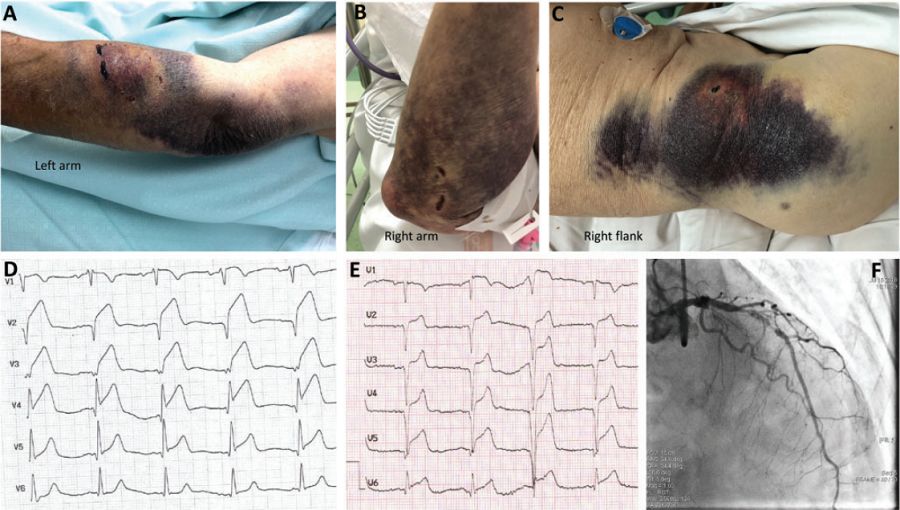 那些年我们遇到的狗狗,那些年我们遇到的狗