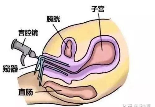妇幼保健院检查月经,江西省妇幼保健院宫腔镜检查