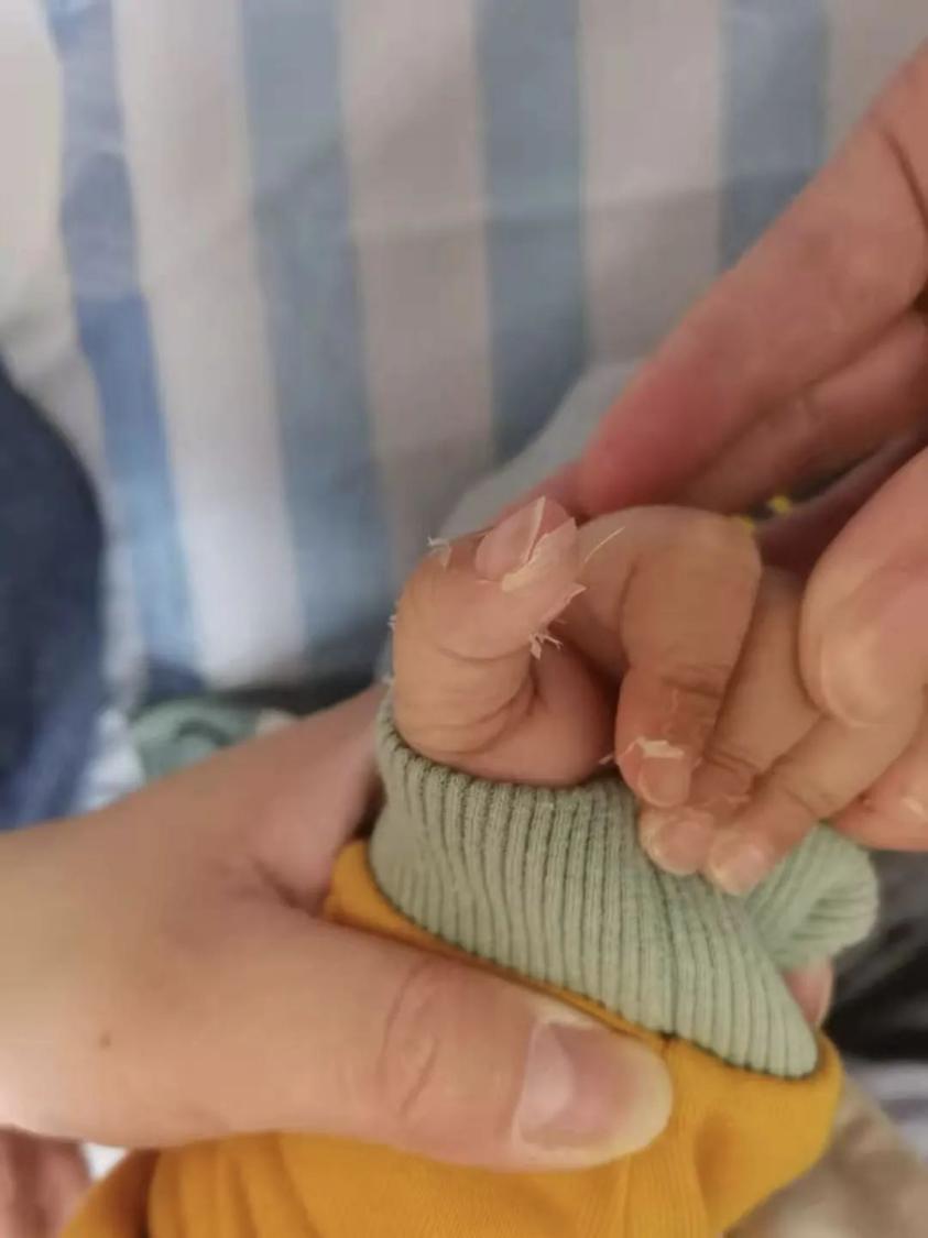 小孩细菌发烧反复不退是什么原因,12岁男孩反复高烧无其他症状