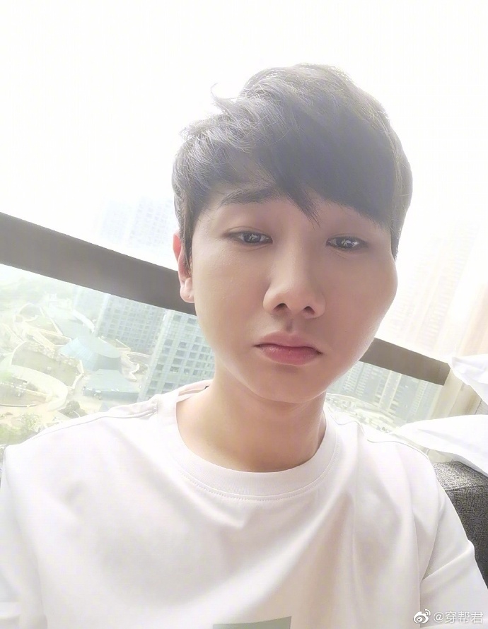 汪苏泷的脸摔肿了,汪苏泷脸肿成蜜蜂小狗