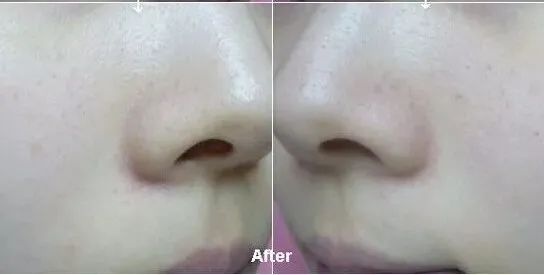 300多元抢大牌:排队也难买的CPB长管隔离!手慢无