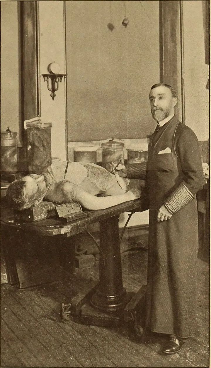 人体解剖的黑暗历史,人体解剖的黑暗故事