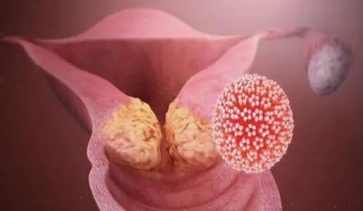 妇幼保健院卵巢肿瘤手术,九江妇幼保健院妇科手术