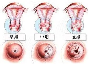 妇幼保健院卵巢肿瘤手术,九江妇幼保健院妇科手术