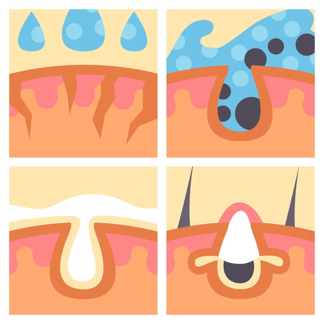 换季皮肤过敏泛红发痒小妙招,换季皮肤过敏最快解决方法