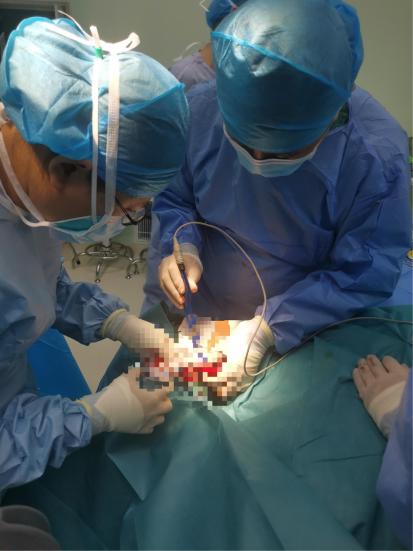 深圳一男子与人发生口角,杭州男子被同事咬掉耳朵