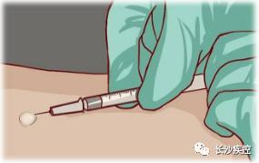 开学新冠疫苗,为什么接种新冠疫苗要查结核菌素