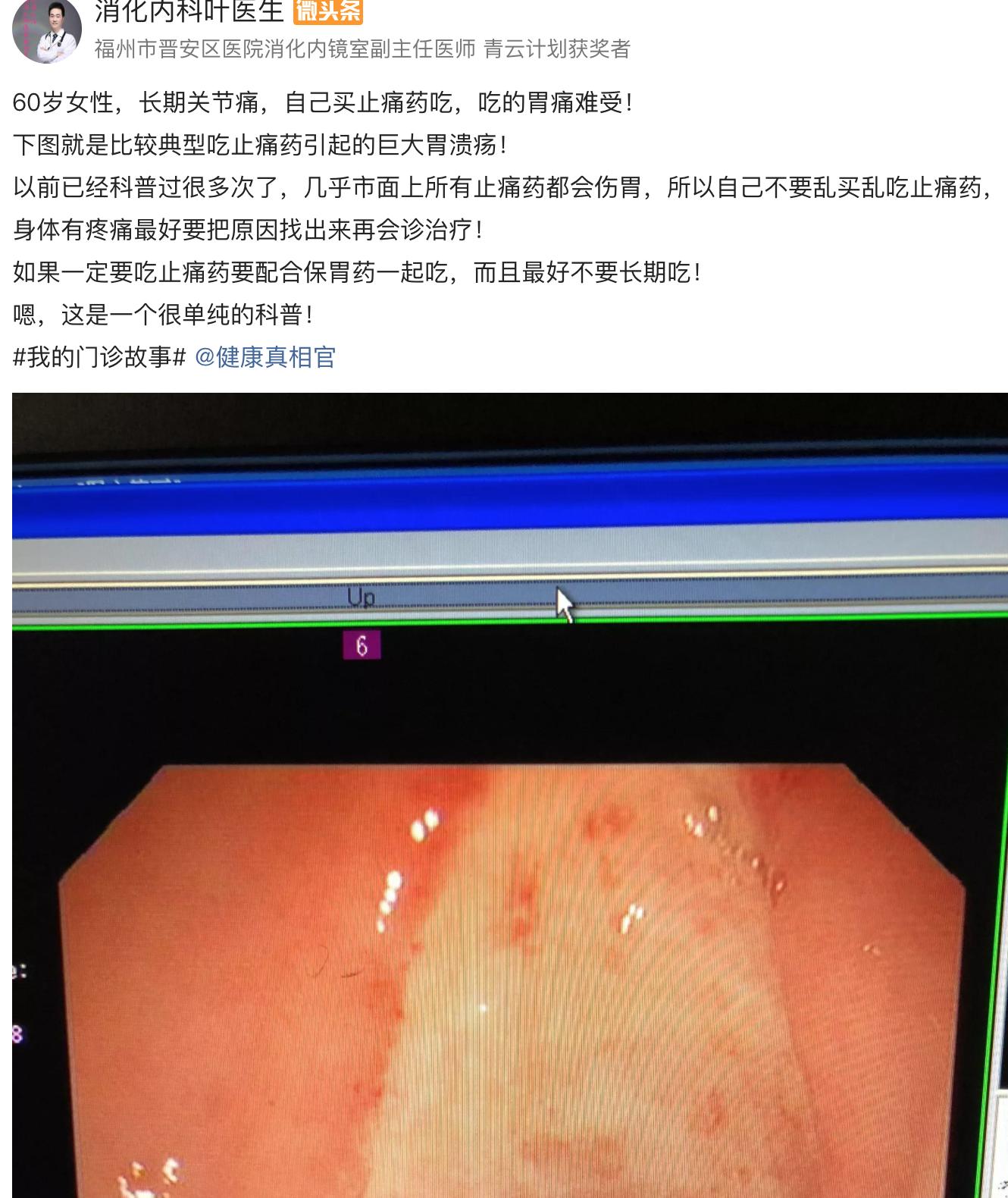 胃为什么吃得太饱就反酸顶气,胃为啥消化那么快