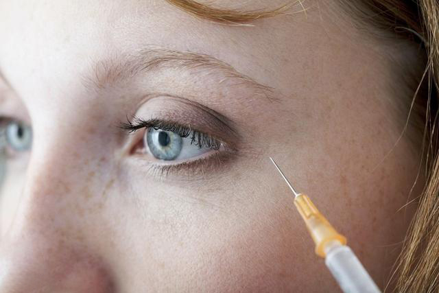 30岁眼部皱纹消除小妙招,40岁女性眼部去皱纹最好的方法