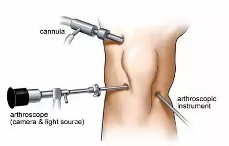 打软腿代表膝盖稳定性不好了么,膝盖打软腿是什么感觉