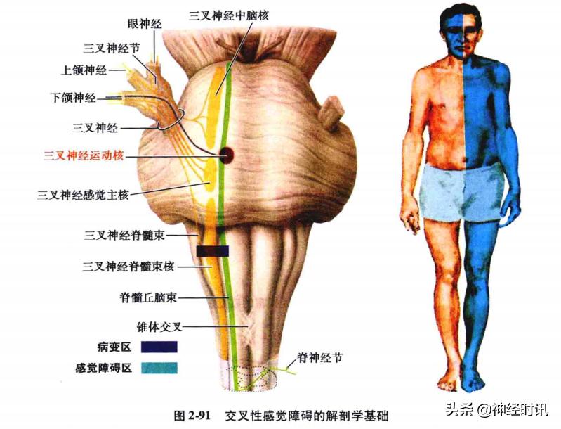 脑干解剖,脑干神经解剖