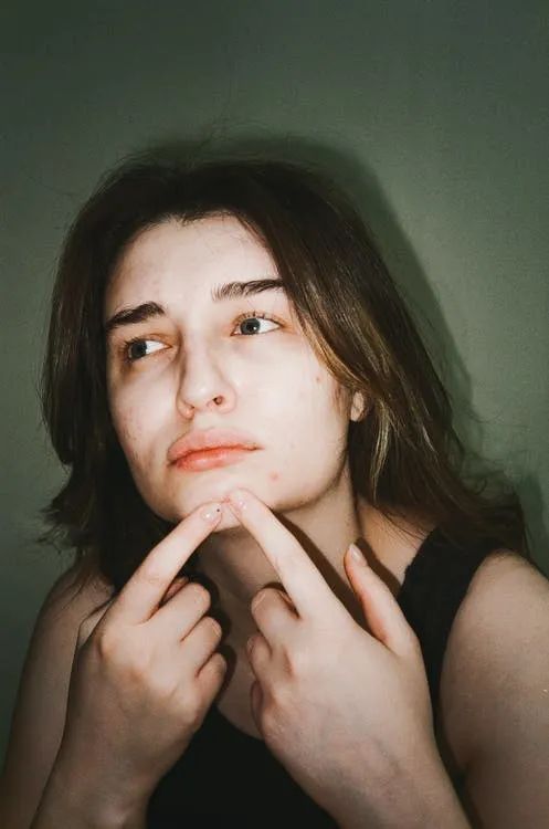 人人吹爆的神仙护肤公式,怎么我一用就烂脸了?