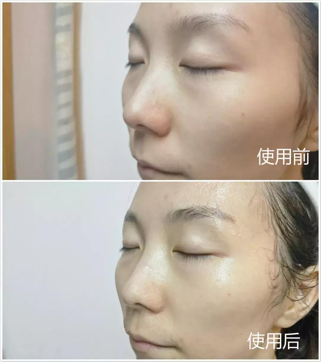 新西兰8分钟面膜真的好吗,新西兰八分钟面膜使用方法