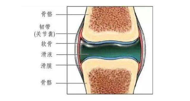 膝关节有积液怎么治疗最好,膝关节积液可以抽出来吗