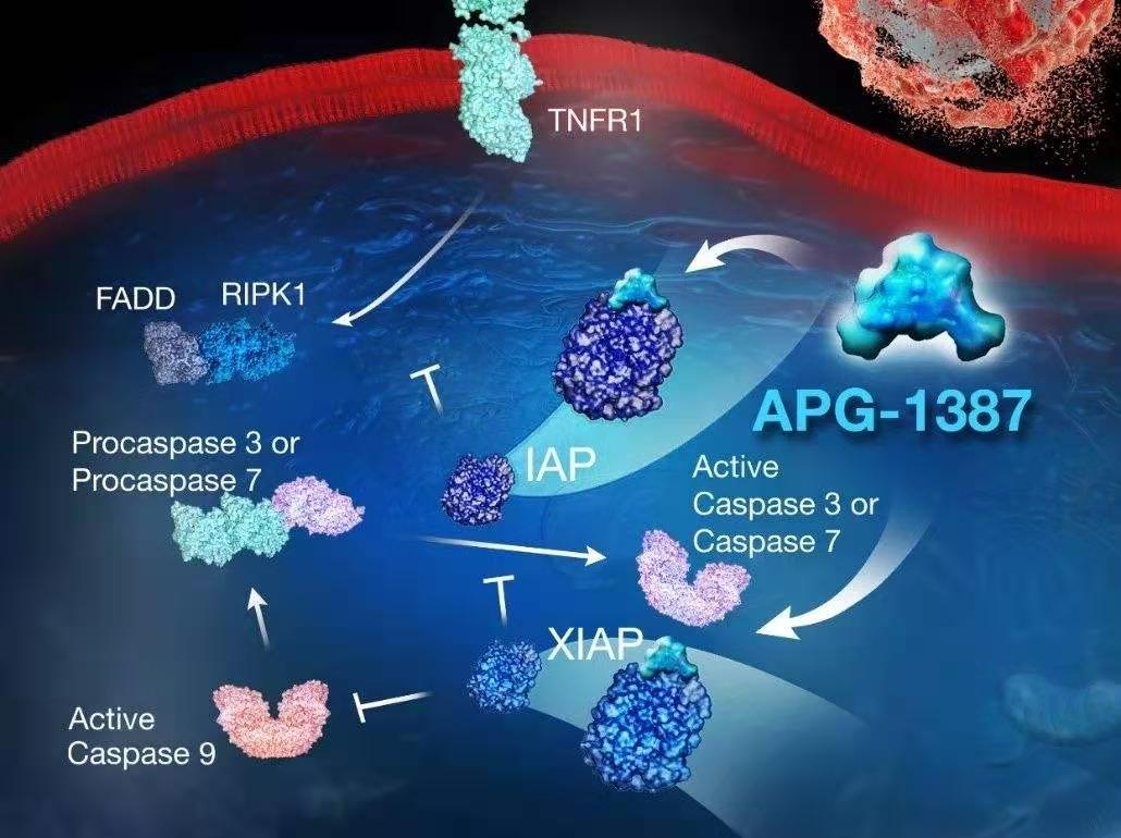 肺泡蛋白沉积症,肺泡蛋白沉积症pas染色阳性表现