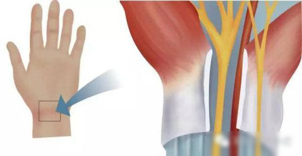 鼠标推荐防鼠标手,垂直鼠标能防鼠标手吗