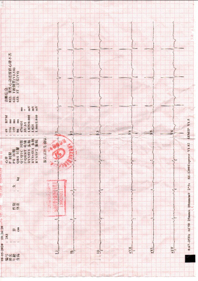 中西医冠心病,中西医结合怎么治疗冠心病心绞痛