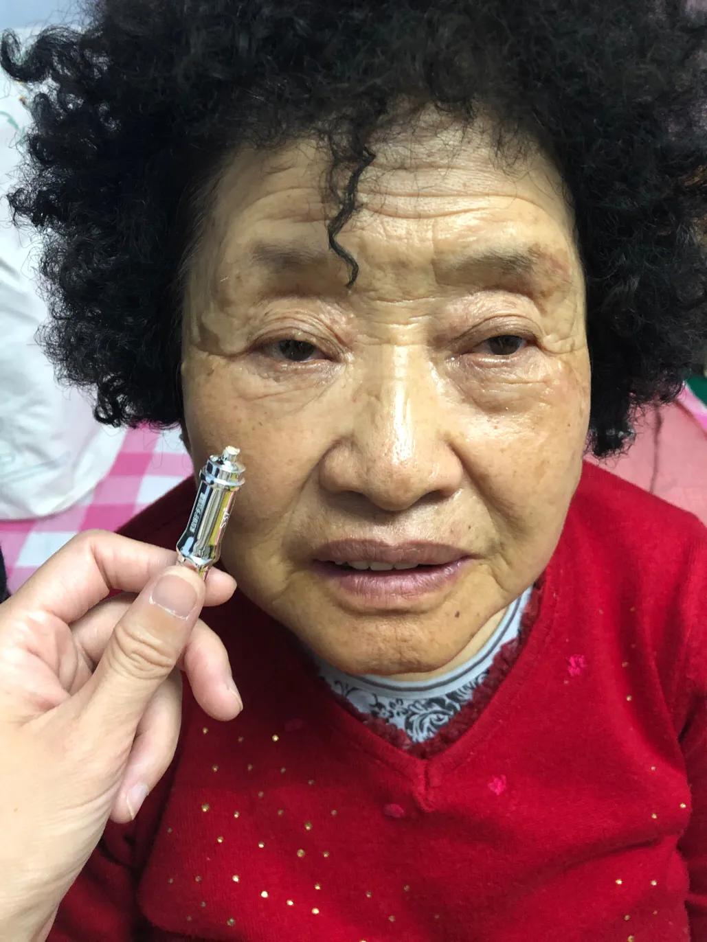 s37微雕眼好用吗,s37微雕眼部套