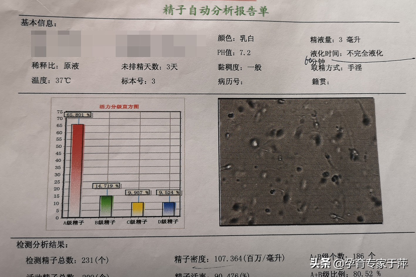 青岛助孕专家于萍：输卵管不孕、多囊，综合治疗喜怀孕