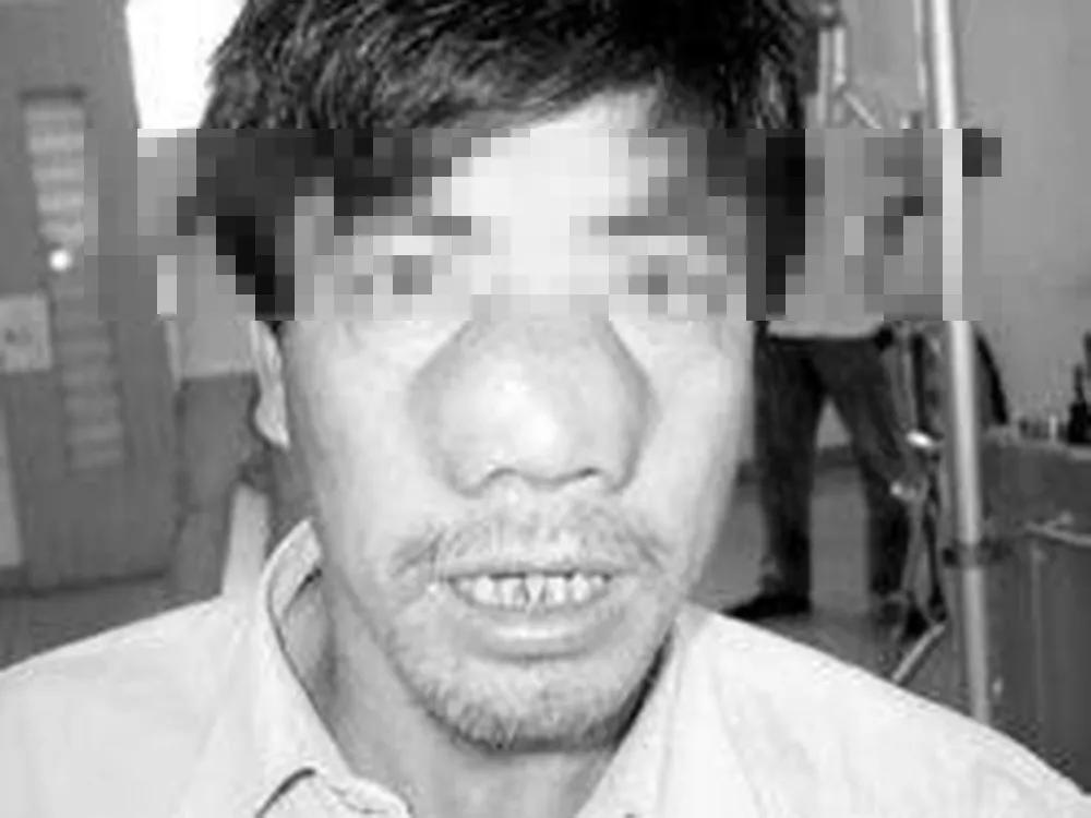 老鼻炎怎么治,老人长期鼻炎需要注意什么