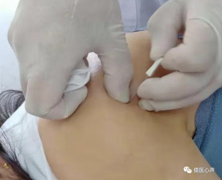 女人肩颈疼是什么原因图,肩膀后骨疼痛怎么解决女性