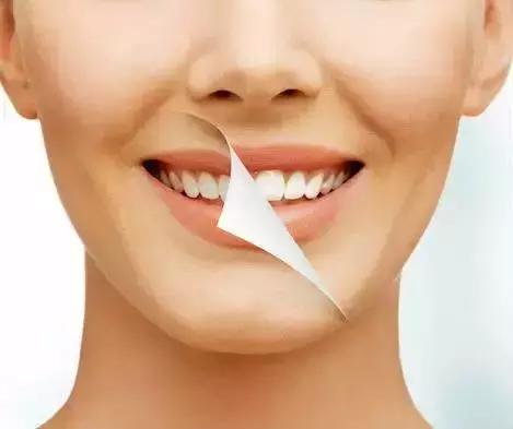 Helen齿科中心——全瓷贴面高科技“美容每一颗牙齿”