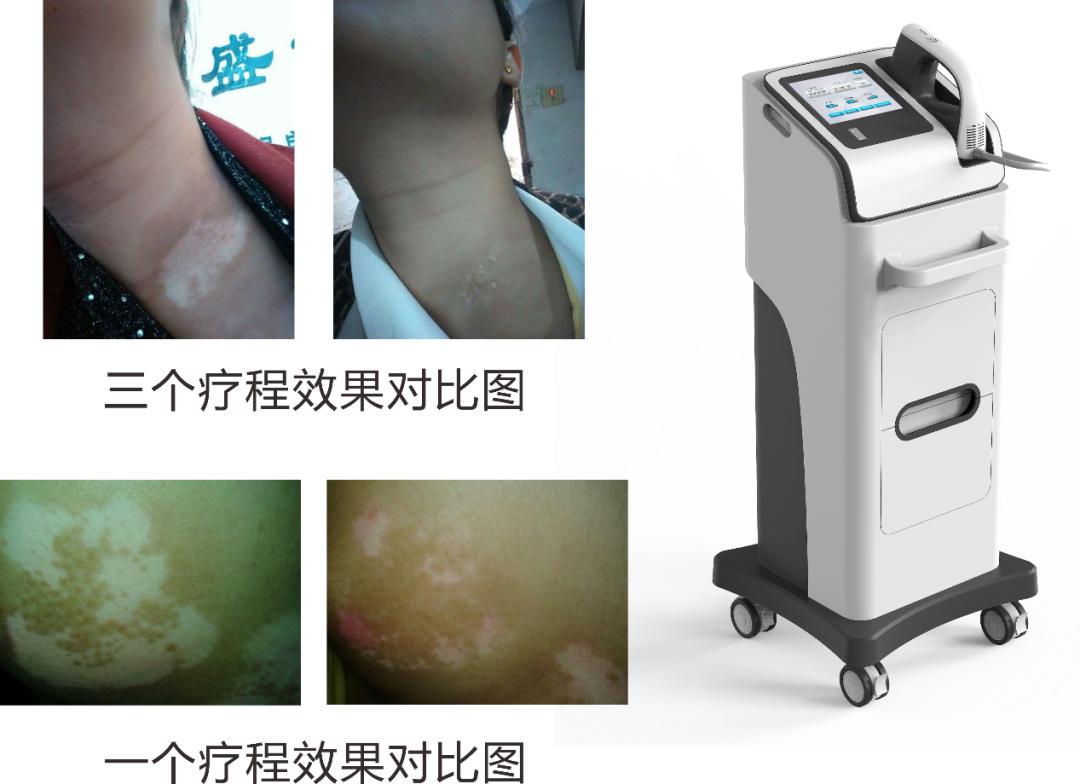 附近治皮肤病最好医院,家附近的皮肤病专科医院