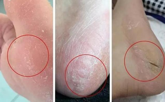 女人养气质秘诀,女人要想气色好吃什么