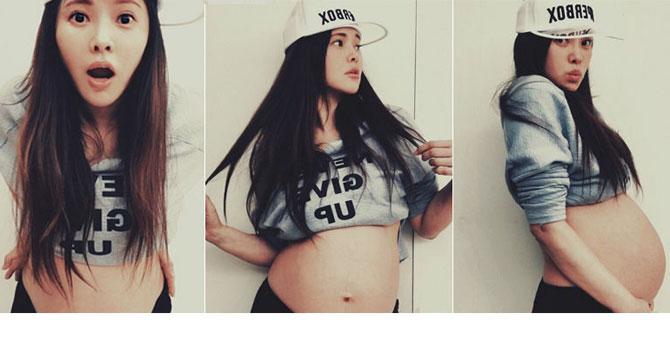 肥胖纹很严重怎么消除,有效去除肥胖纹的方法