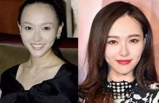 拯救发际线的方法学生,拯救高发际线的最有效方法