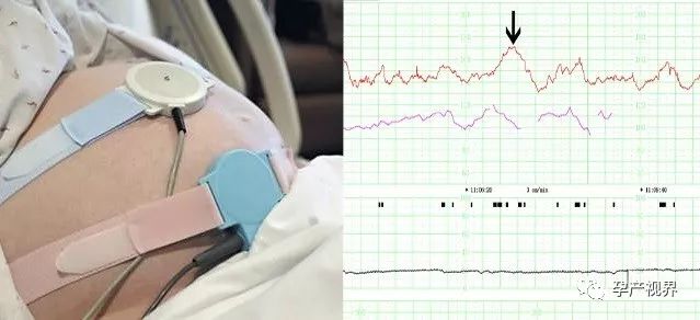 怀孕9周有褐色分泌物b超检查正常,怀孕30周大检查一般检查哪些项目