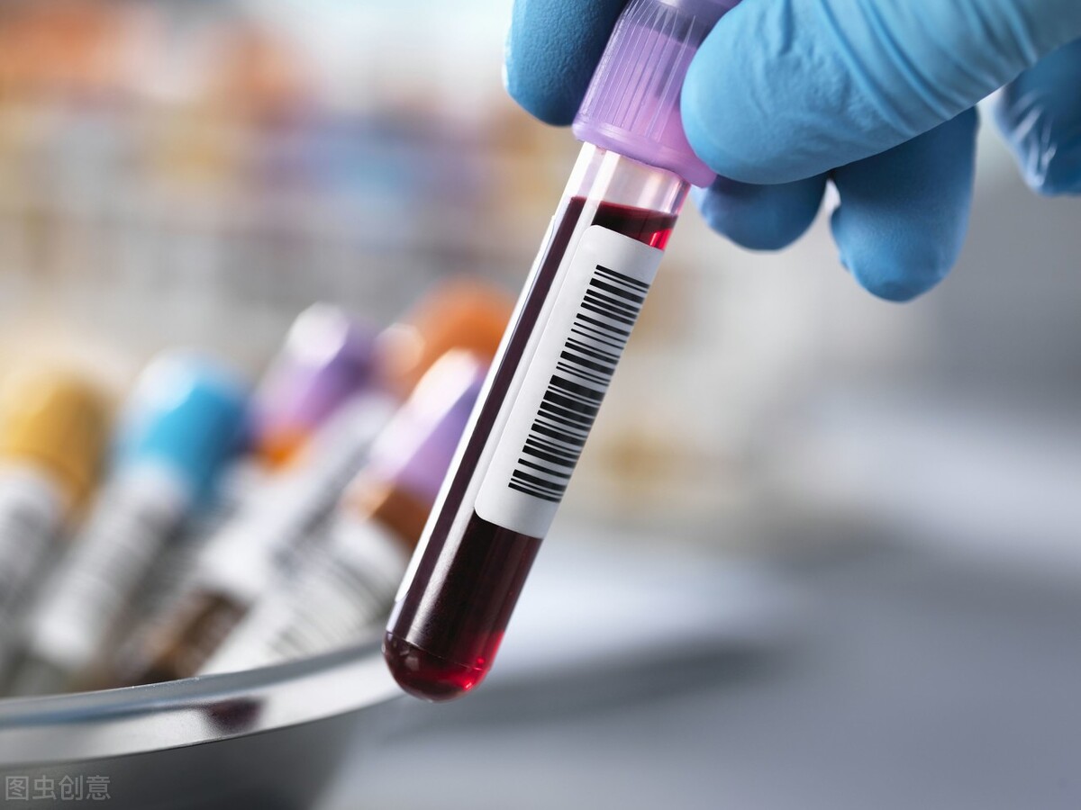 去医院看病为什么总是要抽血,去皮肤科看病要验血吗